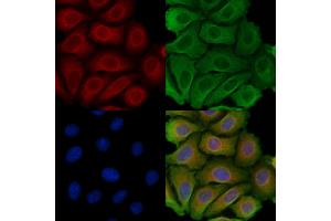 ABIN6257415 and ABIN6275226 staining Hela cells by IF/ICC. (PGRMC2 Antikörper  (C-Term))