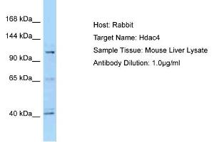 WB Suggested Anti-Hdac4 Antibody   Titration: 1. (HDAC4 Antikörper  (C-Term))