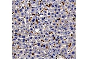 Immunohistochemistry of paraffin embedded rat liver using ANXA3 (ABIN7073065) at dilution of 1: 300 (400x lens) (Annexin A3 Antikörper)