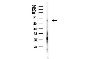 anti-Fucosyltransferase 8 (Alpha (1,6) Fucosyltransferase) (FUT8) (Internal Region) antibody