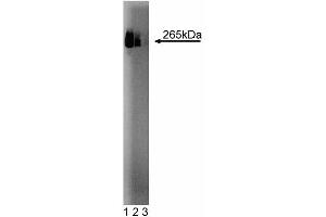 Western blot analysis of Fatty Acid Synthase on HepG2 cell lysate. (Fatty Acid Synthase Antikörper  (AA 9-202))