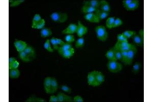 Immunofluorescence staining of HepG2 cells with ABIN7174103 at 1:266, counter-stained with DAPI. (PTPN22 Antikörper  (AA 1-179))