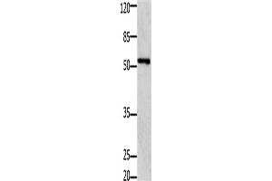 Western Blotting (WB) image for anti-GDNF Family Receptor alpha 1 (GFRA1) antibody (ABIN2431438) (GFRA1 Antikörper)