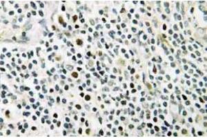 Immunohistochemistry (IHC) analyzes of NPM antibody in paraffin-embedded human tonsil tissue. (NPM1 Antikörper)