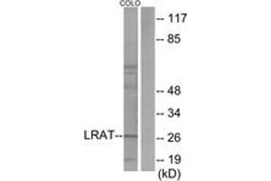 Western blot analysis of extracts from COLO205 cells, using LRAT Antibody. (LRAT Antikörper  (AA 111-160))