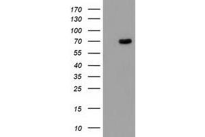 HEK293T cells were transfected with the pCMV6-ENTRY control (Left lane) or pCMV6-ENTRY BCHE (Right lane) cDNA for 48 hrs and lysed. (Butyrylcholinesterase Antikörper)