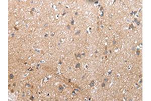 The image on the left is immunohistochemistry of paraffin-embedded Human brain tissue using ABIN7193075(XKR4 Antibody) at dilution 1/20, on the right is treated with synthetic peptide. (XKR4 Antikörper)