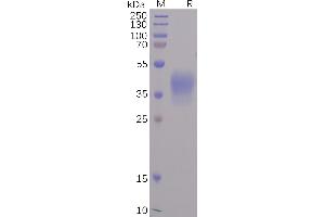 SDS-PAGE (SDS) image for SARS-CoV-2 Spike (AA 310-560) protein (His tag) (ABIN6961176)