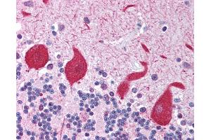 Anti-TLR10 antibody IHC of human brain, cerebellum. (TLR10 Antikörper)