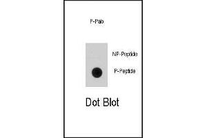 Dot blot analysis of anti-EGFR Phospho-specific Pab (ABIN1881286 and ABIN2850457) on nitrocellulose membrane.