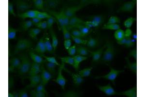 Image no. 10 for anti-Acetyl-CoA Acetyltransferase 2 (ACAT2) antibody (ABIN1496403) (ACAT2 Antikörper)