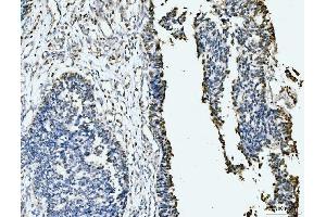 IHC analysis of MCM6 using anti-MCM6 antibody (ABIN7600038). (MCM6 Antikörper  (AA 14-821))