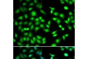 Immunofluorescence analysis of HeLa cells using CDKN2D Polyclonal Antibody (CDKN2D Antikörper)