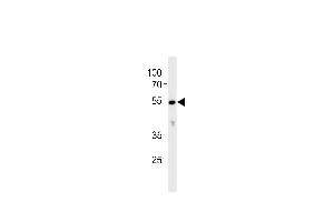Western blot analysis in K562 cell line lysates (35ug/lane). (CYP26C1 Antikörper  (C-Term))