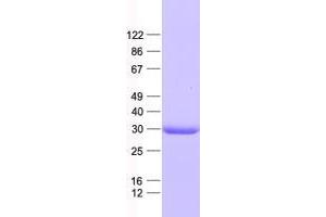 Validation with Western Blot (VGLL1 Protein (His tag))