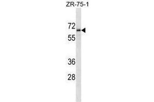 TM117 Antibody (C-term) western blot analysis in ZR-75-1 cell line lysates (35 µg/lane). (TMEM117 Antikörper  (C-Term))