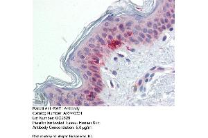 Immunohistochemistry with Human Skin lysate tissue at an antibody concentration of 5. (RAE1 Antikörper  (C-Term))