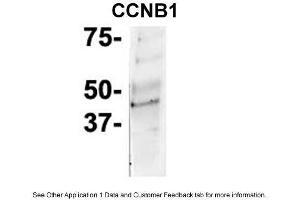 IP Suggested Anti-CCNB1 Antibody Positive Control: NT2 CELL/BRAIN TISSUE