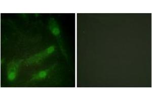 Immunofluorescence analysis of HeLa cells, using Smad2 (Phospho-Thr220) Antibody. (SMAD2 Antikörper  (pThr220))