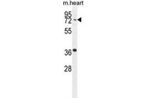CCDC38 Antibody (Center) western blot analysis in mouse heart tissue lysates (35µg/lane). (CCDC38 Antikörper  (Middle Region))