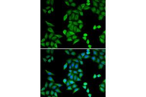 Immunofluorescence analysis of MCF-7 cells using RBPJ antibody (ABIN5973315). (RBPJ Antikörper)