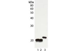 Western blot analysis of Cu/Zn SOD, pAb : Lane 1: Rat liver tissue lysate, Lane 2: Mouse liver tissue lysate, Lane 3: HeLa cell lysate . (SOD1 Antikörper)