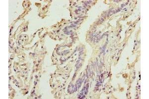Immunohistochemistry of paraffin-embedded human lung tissue using ABIN7146547 at dilution of 1:100 (Calpain 6 Antikörper  (AA 195-494))