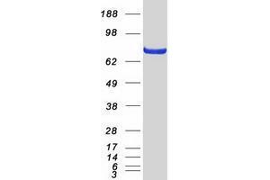 Validation with Western Blot