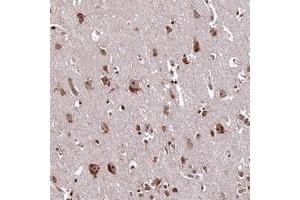 Immunohistochemical staining of human cerebral cortex with PDS5B polyclonal antibody  at 1:200-1:500 dilution. (PDS5B Antikörper)