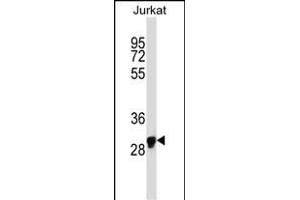 OR1N1 Antikörper  (C-Term)