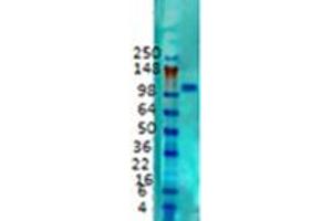 Western Blotting (WB) image for anti-Potassium Voltage-Gated Channel, Shab-Related Subfamily, Member 1 (KCNB1) (C-Term) antibody (ABIN6658107)
