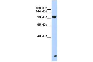 Western Blotting (WB) image for anti-Trinucleotide Repeat Containing 6B (TNRC6B) antibody (ABIN2458485) (TNRC6B Antikörper)