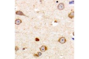 Immunohistochemical analysis of ME3 staining in human brain formalin fixed paraffin embedded tissue section. (ME3 Antikörper  (C-Term))