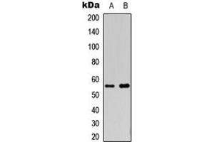 Western blot analysis of Cytochrome P450 2S1 expression in HepG2 (A), COLO205 (B) whole cell lysates.