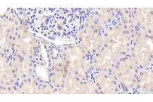 Detection of ENDOG in Human Kidney Tissue using Polyclonal Antibody to Endonuclease G, Mitochondrial (ENDOG) (Endonuclease G Antikörper  (AA 16-290))