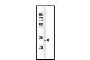 Western blot analysis of Aurora kinase C Antibody (C-term) Cat. (Aurora Kinase C Antikörper  (N-Term))