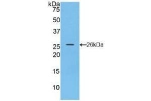 Detection of Recombinant CX43, Rat using Polyclonal Antibody to Connexin 43 (CX43) (Connexin 43/GJA1 Antikörper  (AA 180-382))