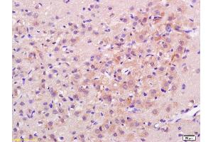 Formalin-fixed and paraffin embedded rat brain labeled with Rabbit Anti H Cadherin/T cadherin Polyclonal Antibody, Unconjugated (ABIN715271) at 1:200 followed by conjugation to the secondary antibody and DAB staining (Cadherin 13 Antikörper  (AA 301-400))