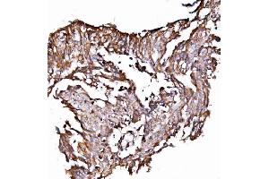 IHC analysis of ORP150/HYOU1 using anti-ORP150/HYOU1 antibody (ABIN7601807).