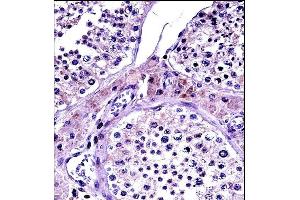 Immunohistochemistry (Paraffin-embedded Sections) (IHC (p)) image for anti-Nuclear Receptor Subfamily 0, Group B, Member 1 (NR0B1) (AA 304-333) antibody (ABIN657696)