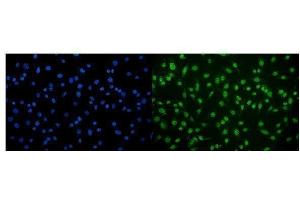 IF analysis of CAMKIV/Camk4 using anti-CAMKIV/Camk4 antibody (ABIN7600419). (CAMK4 Antikörper  (AA 19-469))
