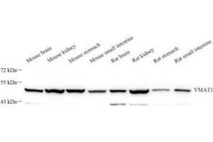 Western blot analysis of VMAT1 (ABIN7075654) at dilution of 1: 1000 (SLC18A1 Antikörper)
