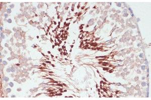 Immunohistochemistry of paraffin-embedded Rat testis using PGK2 Polyclonal Antibody at dilution of 1:100 (40x lens). (PGK2 Antikörper)