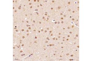Immunohistochemistry (Paraffin-embedded Sections) (IHC (p)) image for anti-DEAD (Asp-Glu-Ala-As) Box Polypeptide 19B (DDX19B) antibody (ABIN7073694)