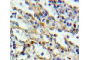 Used in DAB staining on fromalin fixed paraffin-embedded Liver tissue (TLR6 Antikörper  (AA 608-796))