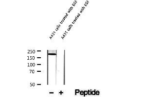 Western blot analysis of extracts of A431 cells treated with EGF, using Phospho-Afadin (Ser1799) Antibody.