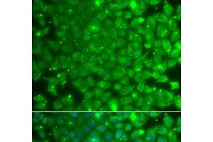 Immunofluorescence analysis of A549 cells using KBTBD7 Polyclonal Antibody (KBTBD7 Antikörper)