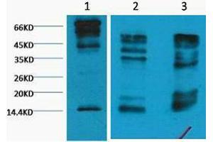 Western Blotting (WB) image for anti-Histone 3 (H3) (H3K9me3) antibody (ABIN3181170) (Histone 3 Antikörper  (H3K9me3))
