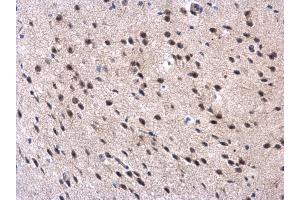Immunohistochemistry (IHC) image for anti-Membrane Protein, Palmitoylated 3 (MAGUK P55 Subfamily Member 3) (MPP3) (Center) antibody (ABIN2856515)
