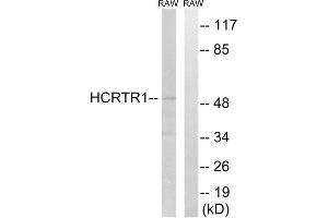 Western blot analysis of extracts from RAW264. (HCRTR1 Antikörper  (Internal Region))